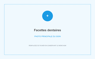 Facettes dentaires à Grandental Clinic