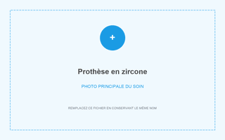 Couronne en zircone réalisée à Grandental Clinic