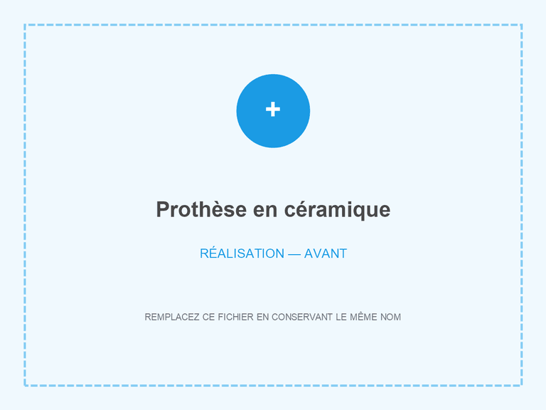 Situation avant restauration en céramique