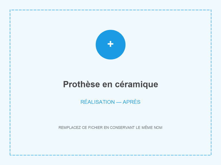 Résultat après restauration en céramique