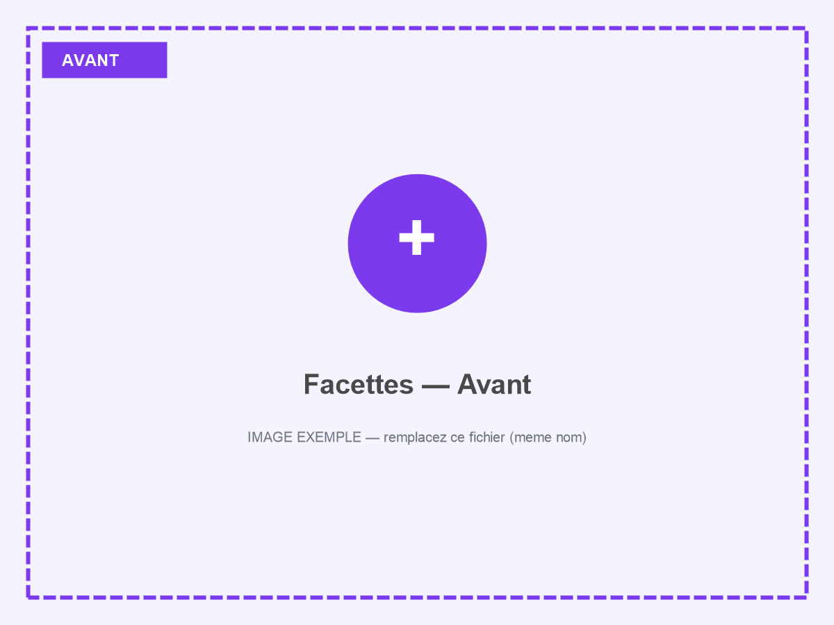 Sourire avant pose de facettes