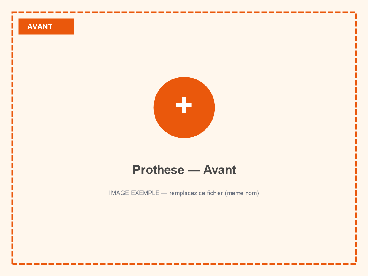 Situation avant restauration prothétique